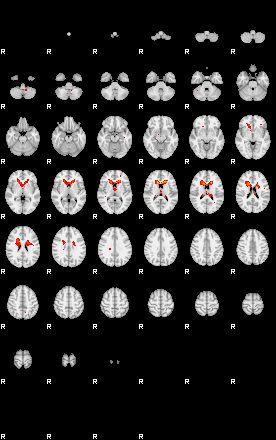 Patients 29101 172