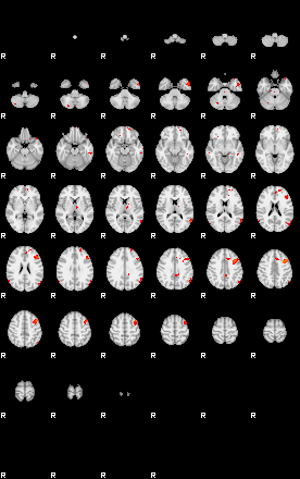 Patients 28718 30