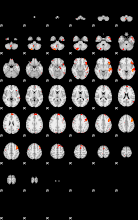 Patients 29008 94