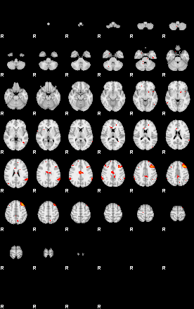 Patients 29160 180