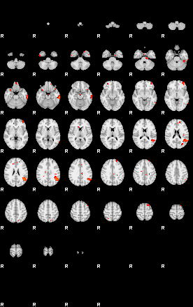 Patients 29201 39