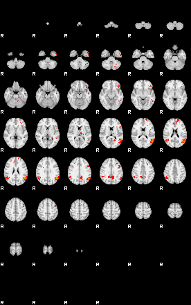 Patients 29013 98