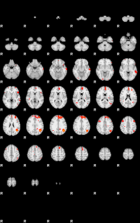 Patients 29101 35