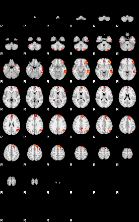 Patients 29669 14