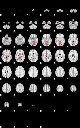 Patients 28816 91