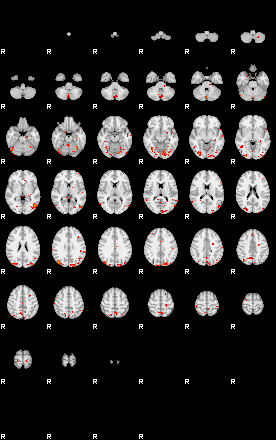 Patients 29012 20