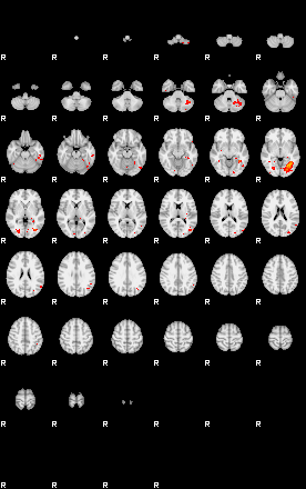 Patients 29017 64