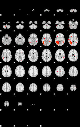 Patients 29107 137