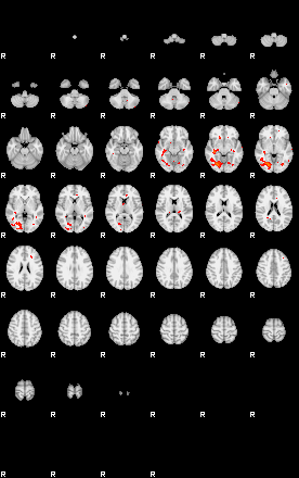 Patients 29278 195