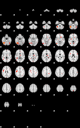 Patients 29449 200