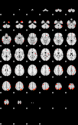 Patients 28817 125