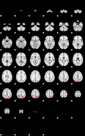 Patients 29030 125