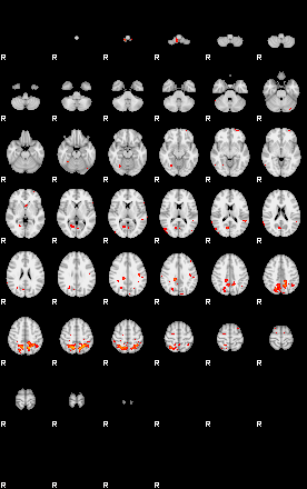 Patients 29062 135