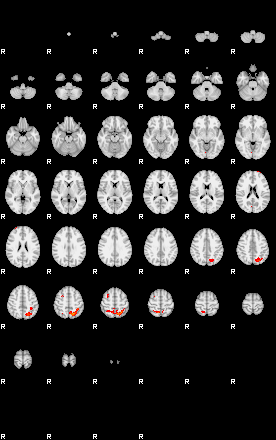 Patients 29102 56