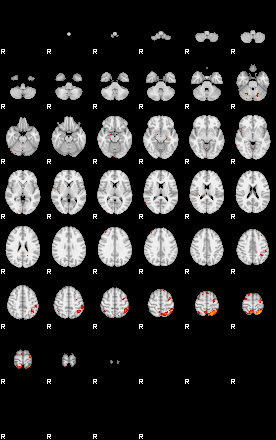 Patients 29152 17