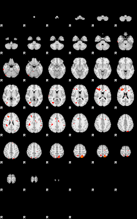 Patients 29174 125