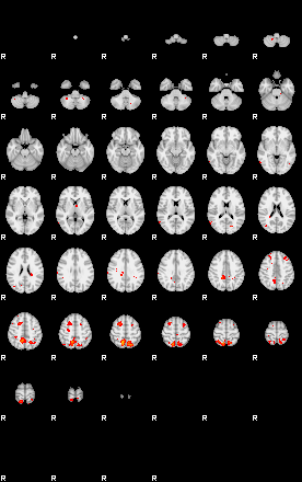 Patients 29180 111