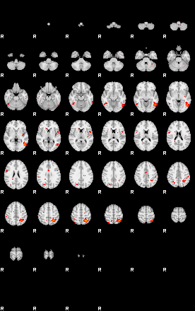 Patients 29184 99