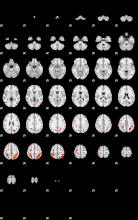 Patients 29199 174