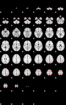 Patients 29200 122