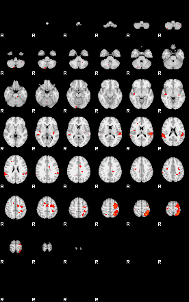 Patients 29202 180