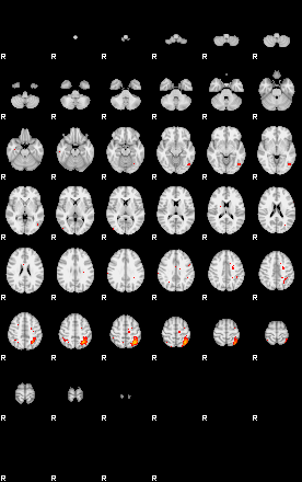 Patients 29509 93