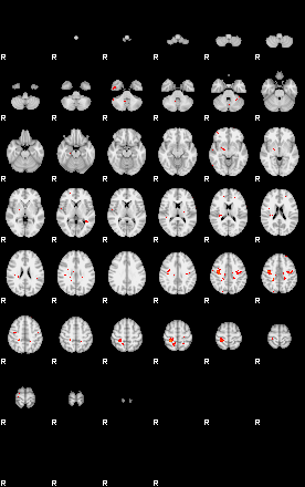 Patients 29539 70