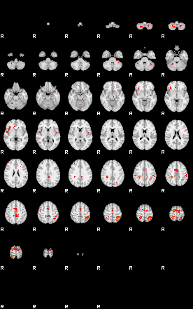 Patients 29799 96