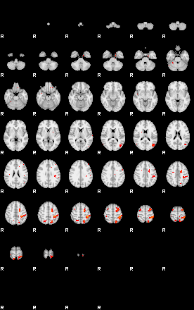 Patients 30014 4