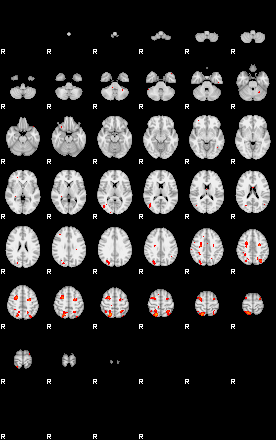 Patients 29201 152