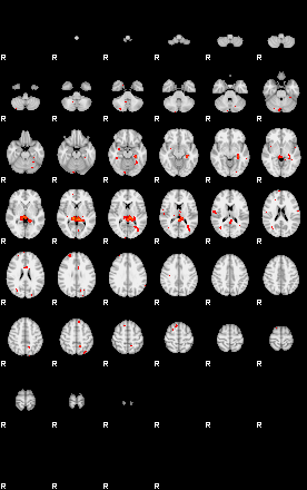 Patients 29221 169