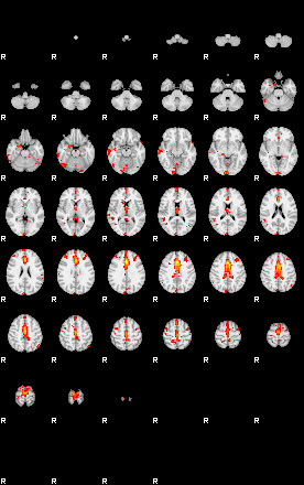 Patients 29161 58