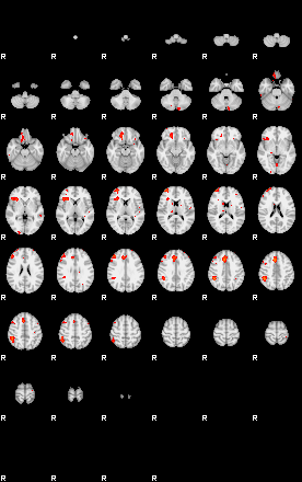 Patients 29170 150