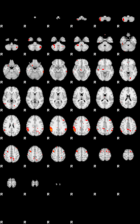 Patients 29208 199