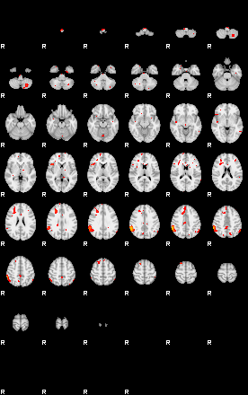 Patients 29213 150