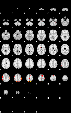 Patients 29417 190