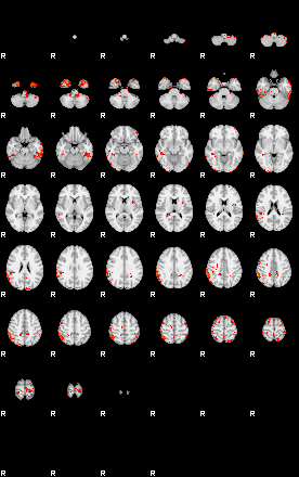 Patients 29503 99