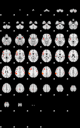 Patients 29539 200