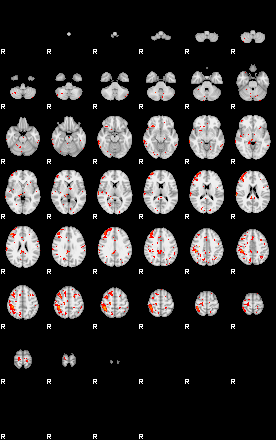 Patients 29615 171