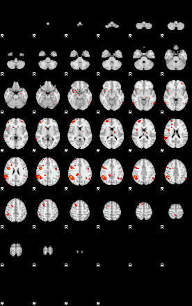 Patients 29411 138