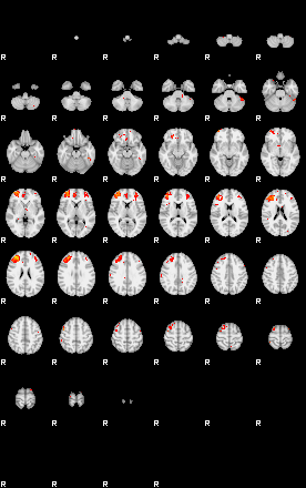 Patients 29540 130