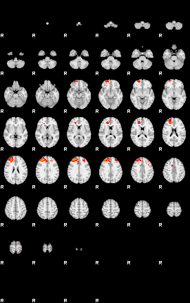 Patients 29169 21