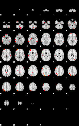 Patients 28995 20