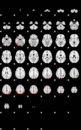 Patients 29559 33