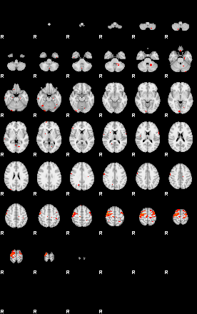 Patients 29028 175