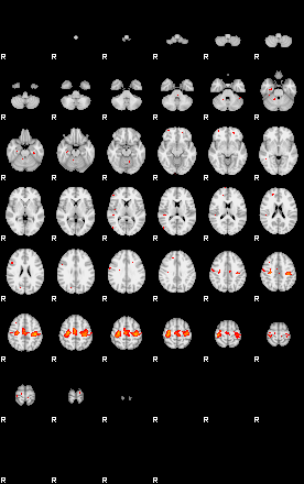 Patients 29200 158