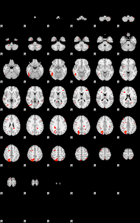 Patients 29212 154