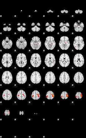 Patients 29153 74