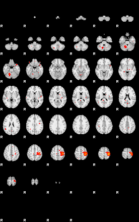 Patients 29220 56