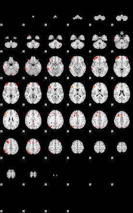 Patients 28718 191